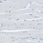 Immunohistochemical staining of human skeletal muscle shows no positivity in myocytes as expected.