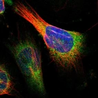 Immunofluorescent staining of human cell line U-251 MG shows localization to endoplasmic reticulum.