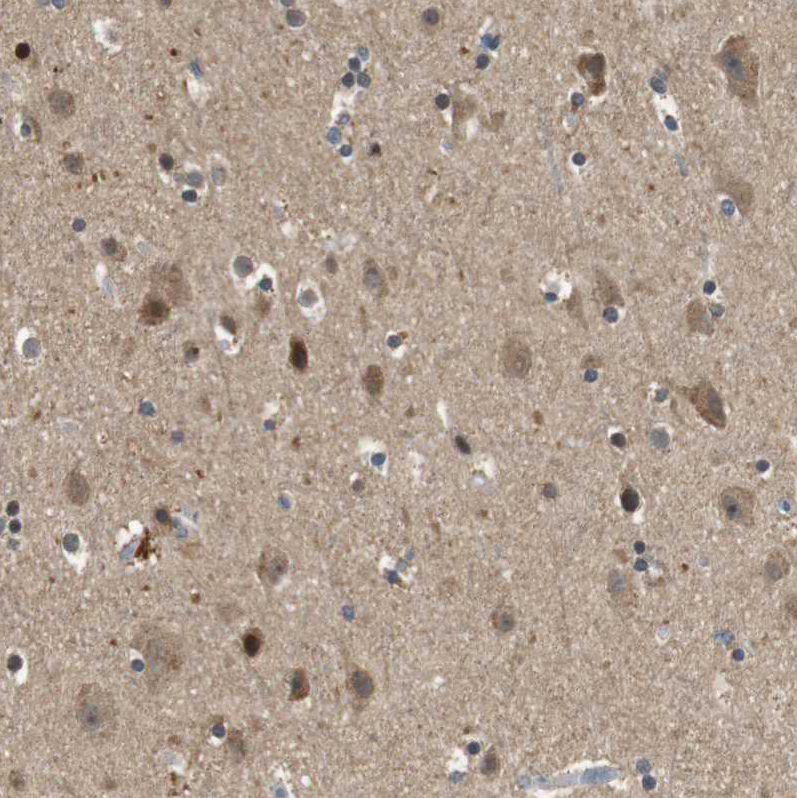 Anti-HSPA13 Antibody