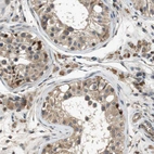 Immunohistochemical staining of human testis shows moderate granular cytoplasmic positivity in cells in seminiferous ducts and leydig cell.
