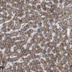 Immunohistochemical staining of human liver shows strong granular cytoplasmic positivity in hepatocytes.