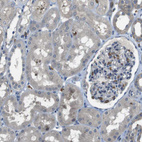 Immunohistochemical staining of human kidney shows moderate membranous positivity in erythrocytes.