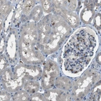 Immunohistochemical staining of human kidney shows moderate membranous positivity in erythrocytes.