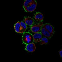 Anti-TNFRSF8 Antibody