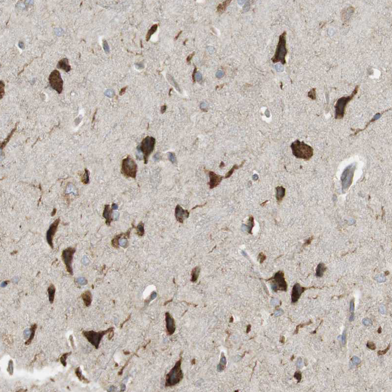 Anti-MBOAT2 Antibody