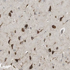 Anti-MBOAT2 Antibody