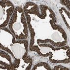Immunohistochemical staining of human prostate shows strong granular cytoplasmic positivity in glandular cells.