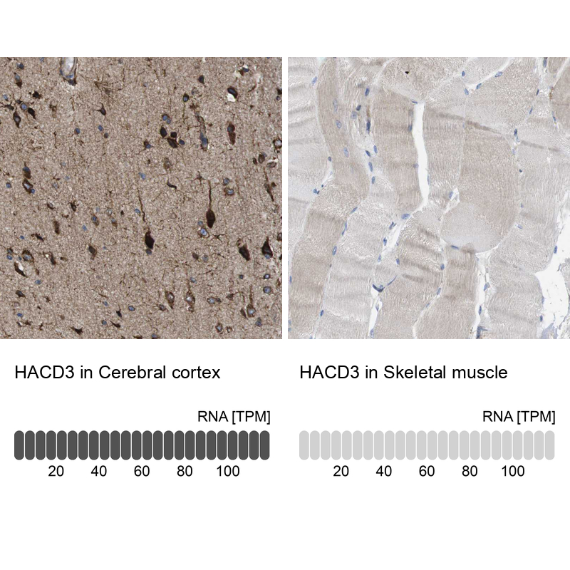 Anti-HACD3 Antibody