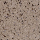 Immunohistochemical staining of human cerebral cortex shows high expression.