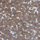 Immunohistochemical staining of human liver shows strong cytoplasmic positivity in hepatocytes.