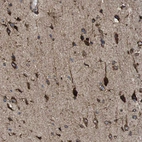 Immunohistochemical staining of human cerebral cortex shows strong cytoplasmic positivity in neuronal cells.