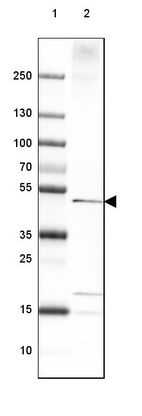 Anti-HACD3 Antibody