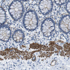 Immunohistochemical staining of human colon strong cytoplasmic positivity in smooth muscle cells.