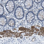 Immunohistochemical staining of human colon strong cytoplasmic positivity in smooth muscle cells.