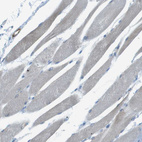 Immunohistochemical staining of human skeletal muscle shows very weak cytoplasmic positivity in myocytes.
