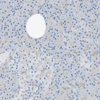 Immunohistochemical staining of human pancreas shows low positivity in exocrine glandular cells as expected.