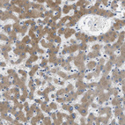 Anti-MPDU1 Antibody