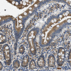 Immunohistochemical staining of human duodenum shows strong cytoplasmic positivity in glandular cells.