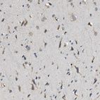 Immunohistochemical staining of human cerebral cortex shows strong cytoplasmic positivity in neurons.