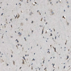 Immunohistochemical staining of human cerebral cortex shows strong cytoplasmic positivity in neurons.