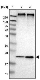 Lane 1: Marker [kDa] 230, 130, 95, 72, 56, 36, 28, 17, 11_br/_Lane 2: Human cell line RT-4_br/_Lane 3: Human cell line U-251MG sp