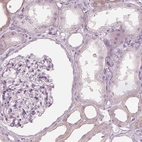 Immunohistochemical staining of human kidney shows low expression as expected.