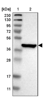 Lane 1: Marker [kDa] 230, 130, 95, 72, 56, 36, 28, 17, 11_br/_Lane 2: Human cell line RT-4