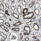 Anti-KCNE3 Antibody