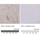 Anti-NEFL Antibody