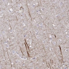 Immunohistochemical staining of human cerebral cortex shows strong positivity in neuronal processes.