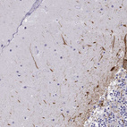 Immunohistochemical staining of human cerebellum shows strong positivity in neuronal processes in molecular layer.