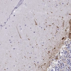 Immunohistochemical staining of human cerebellum shows strong positivity in neuronal processes in molecular layer.