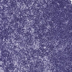 Immunohistochemical staining of human lymph node shows no positivity in non-germinal center cells as expected.