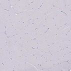 Immunohistochemical staining of human skeletal muscle shows no positivity in myocytes as expected.