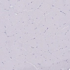 Immunohistochemical staining of human skeletal muscle shows no positivity in myocytes as expected.