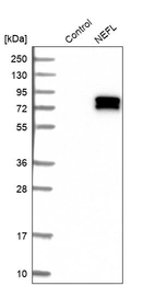 Western blot analysis in control (vector only transfected HEK293T lysate) and NEFL over-expression lysate (Co-expressed with a C-terminal myc-DDK tag (~3.1 kDa) in mammalian HEK293T cells, LY416829).
