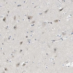 Immunohistochemical staining of human cerebral cortex shows strong nuclear positivity in neurons.
