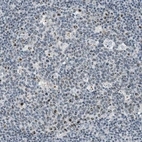 Immunohistochemical staining of human tonsil shows strong nuclear positivity in germinal center cells.