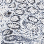 Immunohistochemical staining of human rectum shows moderate nuclear positivity in glandular cells.