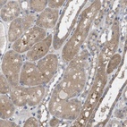 Anti-BCAR3 Antibody