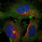 Immunofluorescent staining of human cell line U-251 MG shows localization to plasma membrane, cytosol & centrosome.
