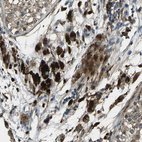Immunohistochemical staining of human testis shows strong cytoplasmic positivity in Leydig cells.