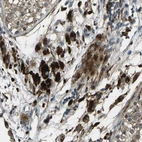 Immunohistochemical staining of human testis shows strong cytoplasmic positivity in Leydig cells.
