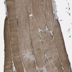 Immunohistochemical staining of human skeletal muscle shows moderate cytoplasmic positivity in myocytes.