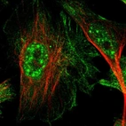 Immunofluorescent staining of human cell line U-251 MG shows localization to nuclear speckles, plasma membrane & intermediate filaments.