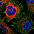 Immunofluorescent staining of human cell line U-251 MG shows localization to plasma membrane & cytosol.