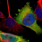 Immunofluorescent staining of human cell line U-251 MG shows localization to cytosol & centrosome.