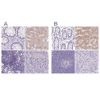 Immunohistochemical staining of human colon, liver, lymph node and pancreas using Anti-ASGR2 antibody HPA014899 (A) shows similar protein distribution across tissues to independent antibody HPA015998 (B).