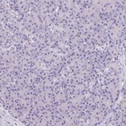 Immunohistochemical staining of human pancreas shows low expression as expected.