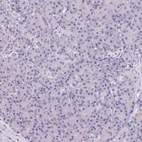 Immunohistochemical staining of human pancreas shows low expression as expected.